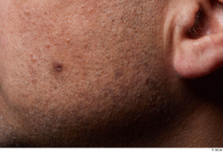 Face Cheek Ear Skin Man Birthmarks Chubby Studio photo references